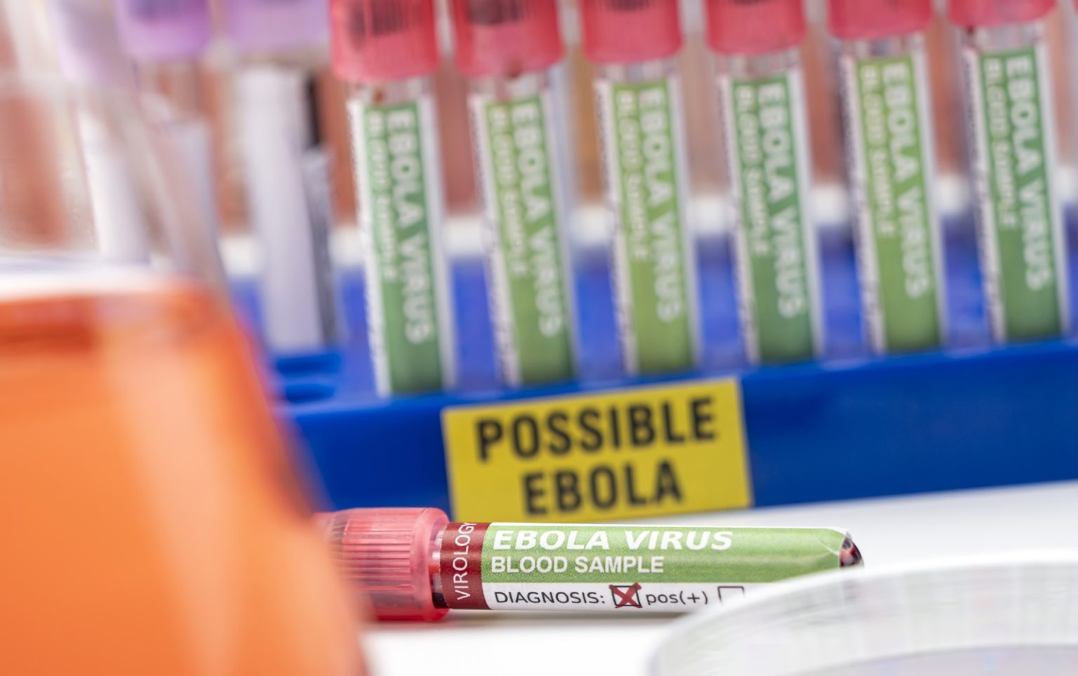 Blood sample from Ebola patient
