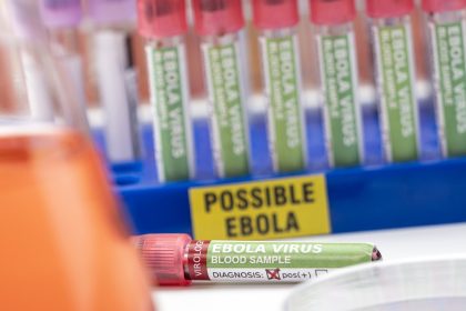 Blood sample from Ebola patient