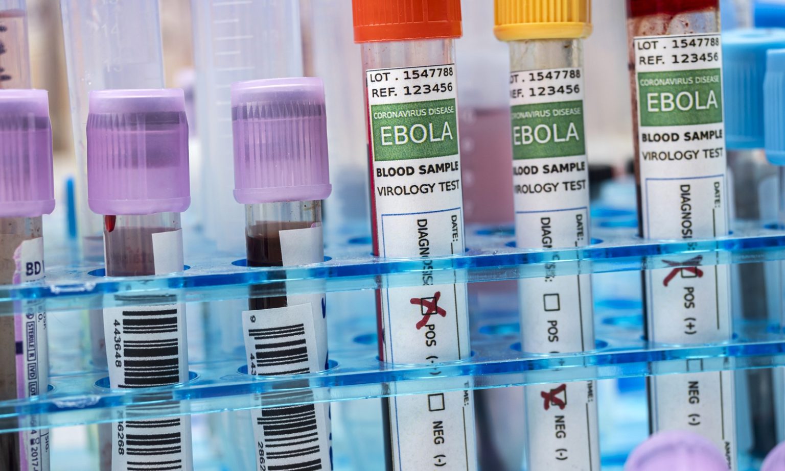 Blood sample from Ebola patient, positive result, conceptual image
