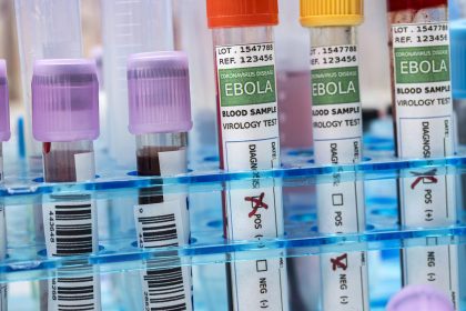 Blood sample from Ebola patient, positive result, conceptual image